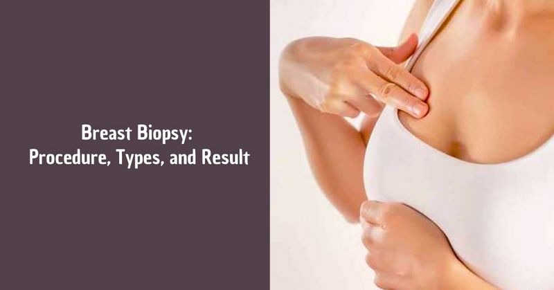 How to Prepare For a Breast Biopsy